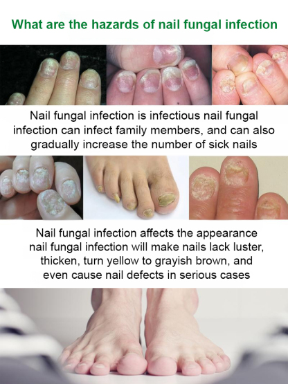 SOUTH MOON Nail Care Solution