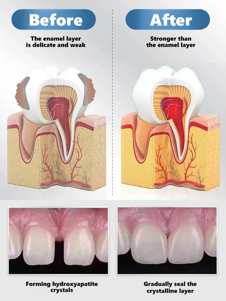 😱 THIS is what dental clinics don’t want to spread!【Say Goodbye to Fake Braces & Grow New Teeth】Natural Tooth Growth Care Solution