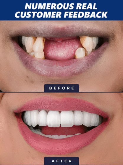 😱 THIS is what dental clinics don’t want to spread!【Say Goodbye to Fake Braces & Grow New Teeth】Natural Tooth Growth Care Solution