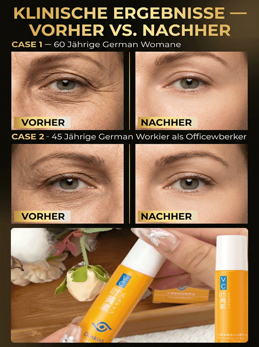 Anti-Falten und Glättendes Augenserum-Öl