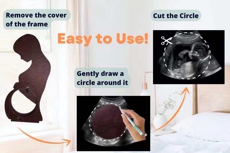 Rovenal®Handmade Mumogram Ultrasound Photo Frame🤰