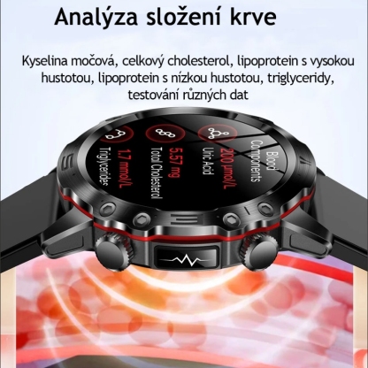 CHYTRÉ HODINKY S AI MEDICÁNSKOU DIAGNOSTIKOU - 2025 NOVÉ HODINKY S MĚŘENÍM KREVNÍCH LIPIDŮ, KYSELINY MOČOVÉ, HLADINY GLUKÓZY V KRVI - EKG+PPG, FITNESS TRACKER
