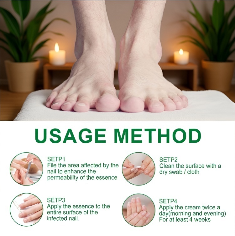 【Nail Care Solution】Eliminate onychomycosis in 7 days!