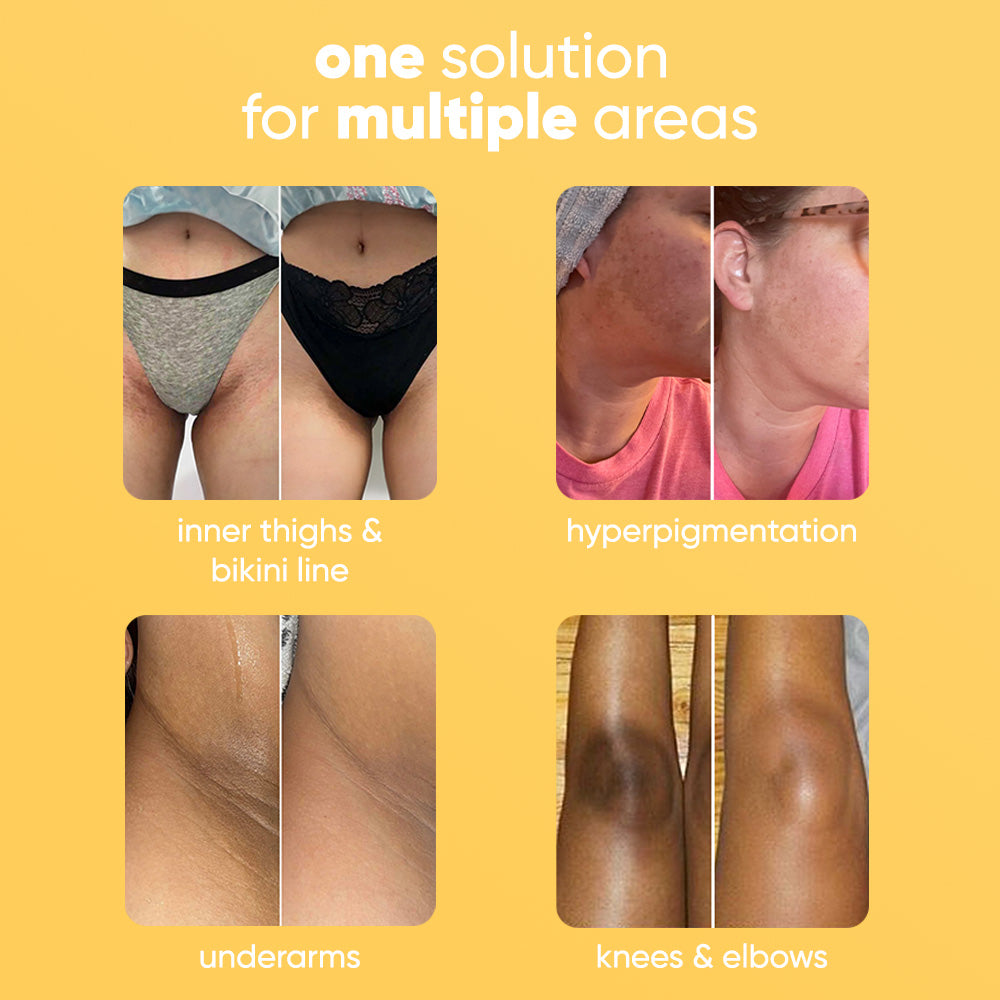 Lemon Turmeric & Kojic Acid Brightening Soap