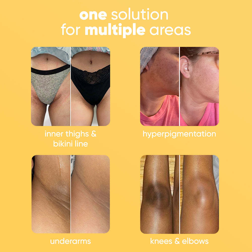 Lemon Turmeric & Kojic Acid Brightening Soap