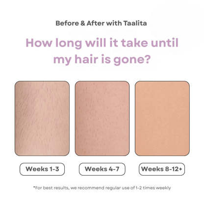 IPL Hårborttagningsenhet för Hemmabruk