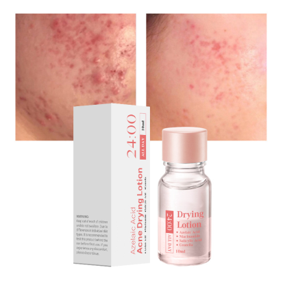 Salicylsyra Spot Treatment – Snabbverkande nattbehandling mot pormaskar & finnar