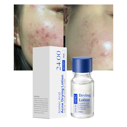 Salicylsyra Spot Treatment – Snabbverkande nattbehandling mot pormaskar & finnar
