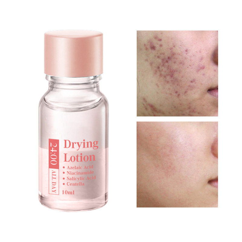 Salicylsyra Spot Treatment – Snabbverkande nattbehandling mot pormaskar & finnar