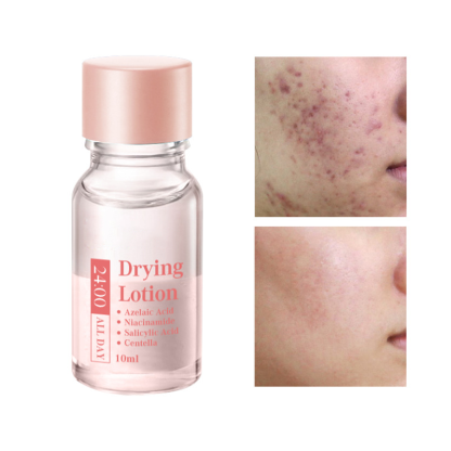 Salicylsyra Spot Treatment – Snabbverkande nattbehandling mot pormaskar & finnar