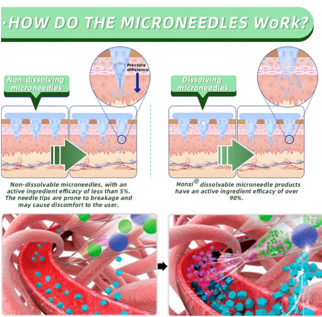 IDEACLOTH™ MICRONEEDLE SLIM PATCHES (X6 BOX – 24 PCS)