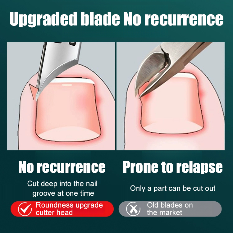 Relieve Ingrown Pain Instantly 🦶 25° Precision Slant Blade Clipper for Thick & Deep Toenails - Cut Like Butter! ✂️