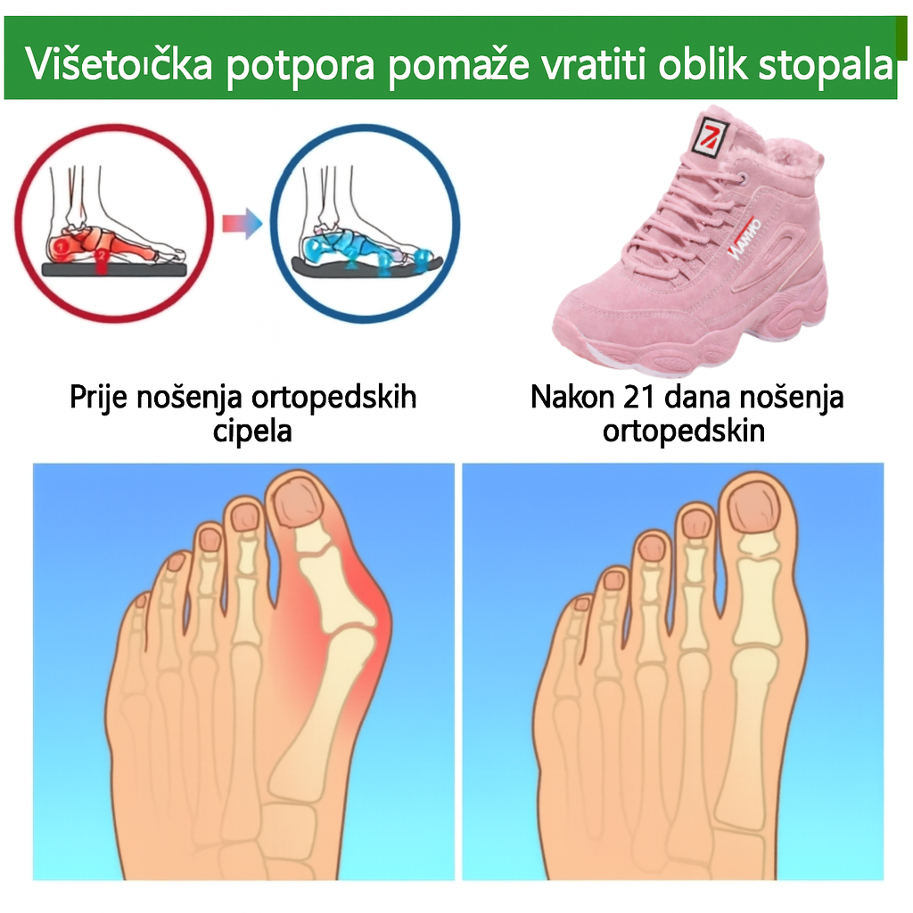 ⏰Vremenski ograničena ponuda🔥Dizajnirao terapeut✅Pogodno za široka stopala, toplo, udobno i bez pritiska.