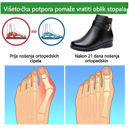 🔥Od australskog brenda⏰ Ergonomske, vodootporne, kožne gležnjače koje učinkovito ublažavaju bol - Nova zimska kolekcija