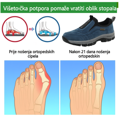 🔥Posebna ponuda s 30% popusta na ograničeno vrijeme⏰ Ortopedske cipele od brušene kože australskog luksuznog brenda koje ublažavaju bol u stopalima i nude izvrsnu potporu🦶 - Vodootporne i neklizajuće