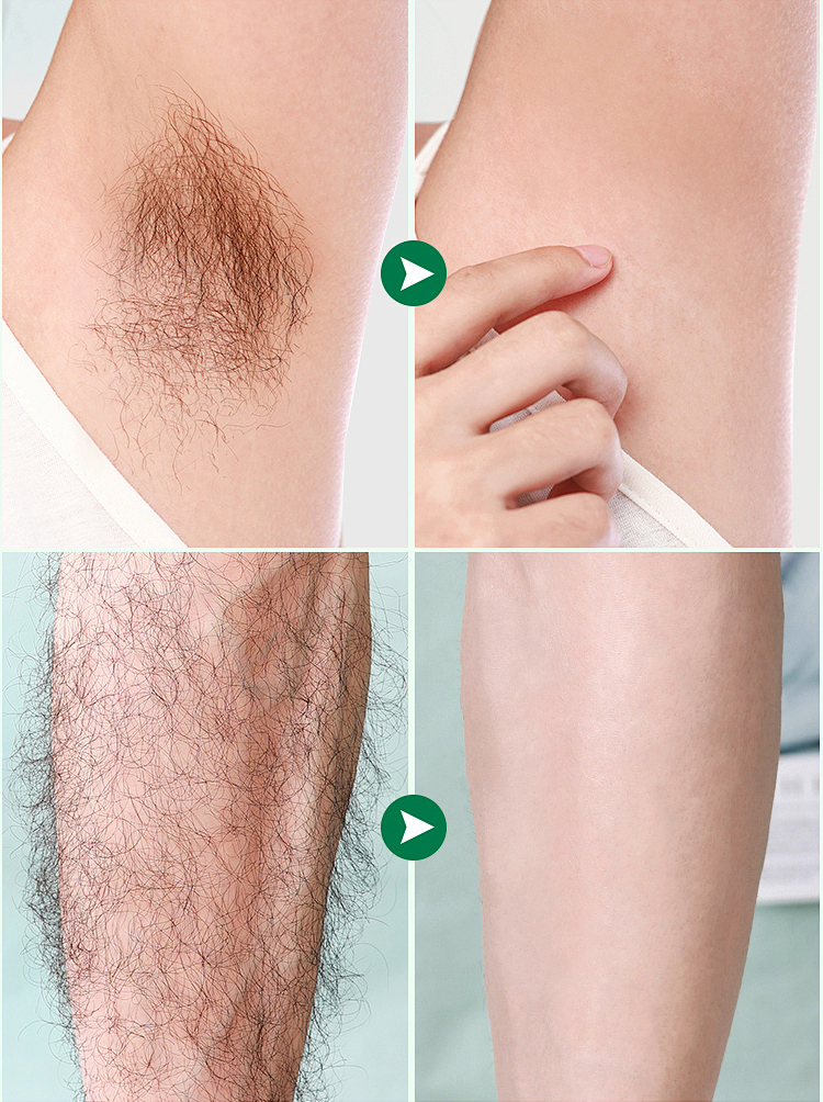 【Powerful Cleaning】Painless Body Hair Removal Cream