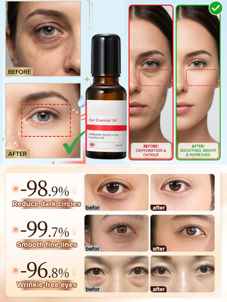 Anti-wrinkle eye essential oil