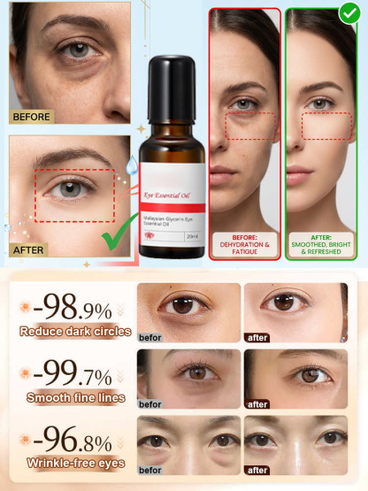 Anti-wrinkle eye essential oil