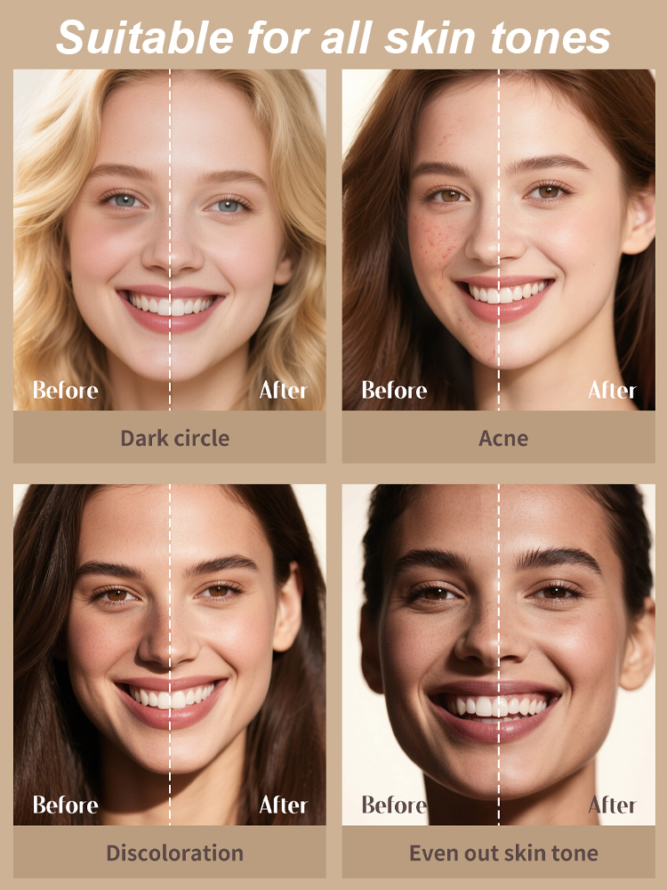 🌟 Bye Dark Circles ✨ Hello Bright Eyes! ✅ Instantly evens tone ✅ Minimizes wrinkles & fine lines