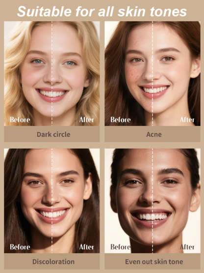 🌟 Bye Dark Circles ✨ Hello Bright Eyes! ✅ Instantly evens tone ✅ Minimizes wrinkles & fine lines