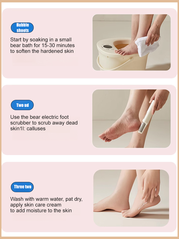 Electric foot scrubber✔️ Removes dead skin and calluses✔️ Leaves your feet soft and smooth✔️ Easy to use, immediate results✔️ Extra rolling heads for gentle and deep exfoliation