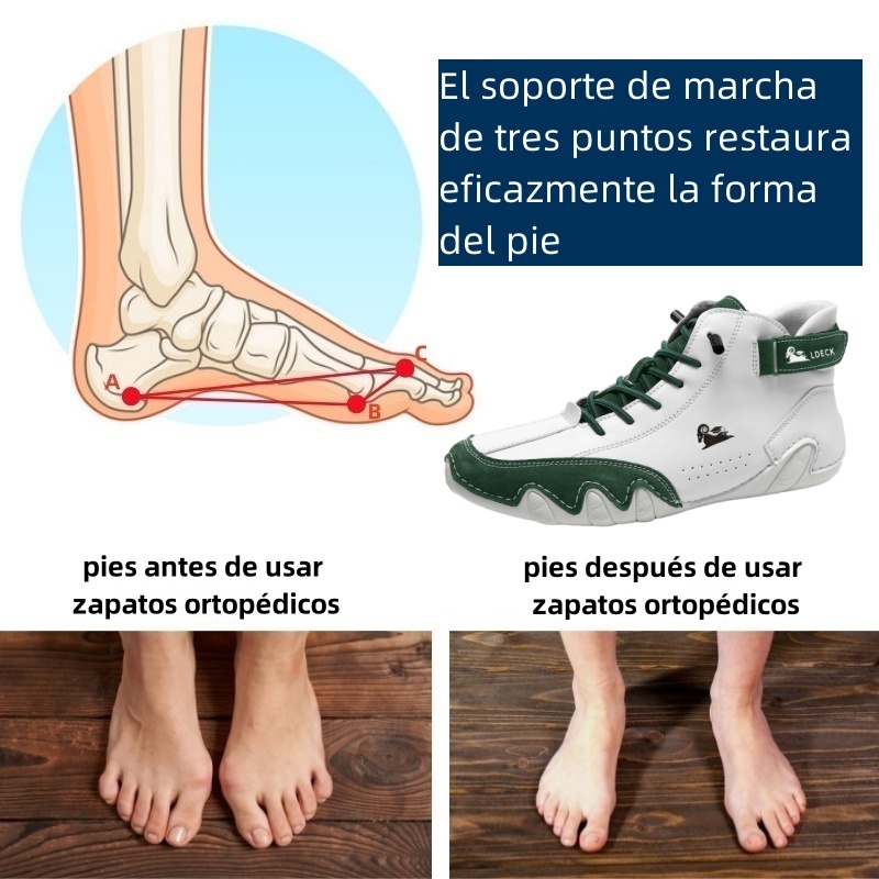 Riccicall® - Zapatos ortopédicos ergonómicos de piel, impermeables, alivian el dolor de pies - unisex