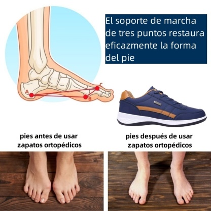 Riccicall® – Calzado ortopédico médico de diseño ergonómico que alivia el dolor de espalda, articulaciones y piernas.