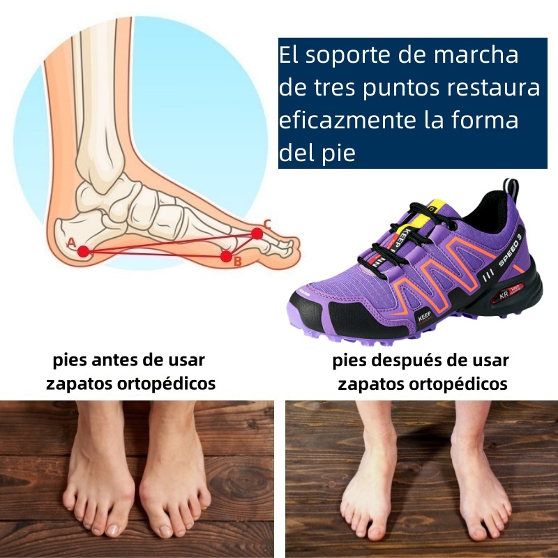 Zapatos ortopédicos diseñados ergonómicamente para dolores de espalda, articulaciones y pies: adecuados para todas las mujeres.