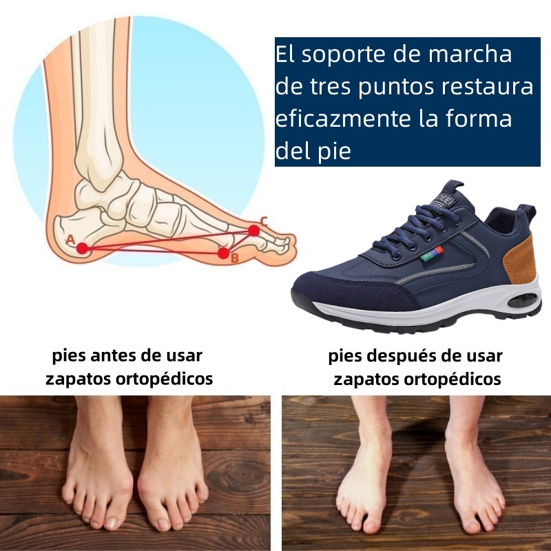 Riccicall® – Calzado ortopédico médico de diseño ergonómico que alivia el dolor de espalda, articulaciones y piernas.