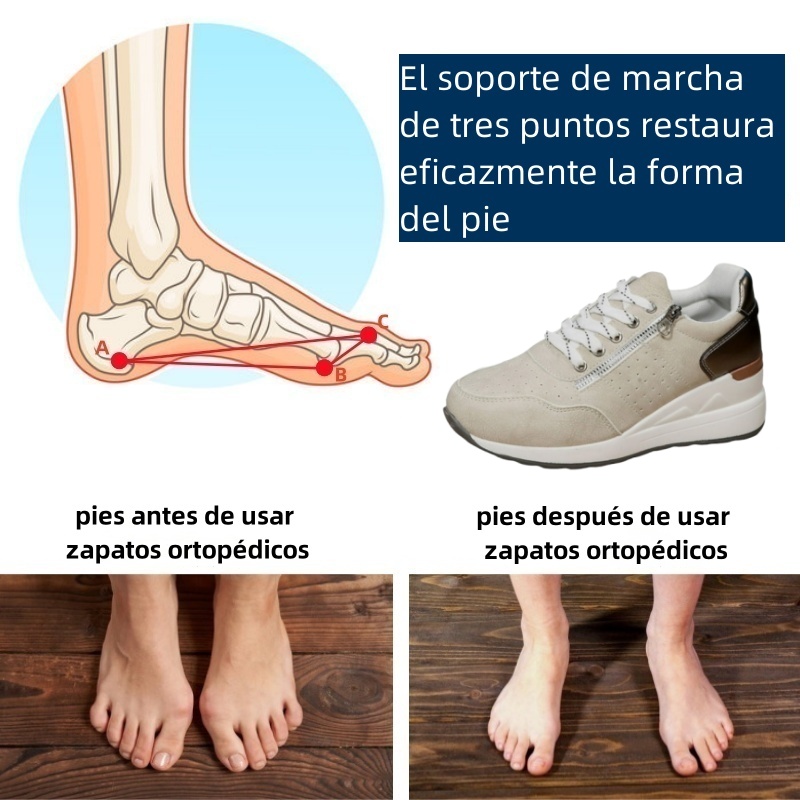 Riccicall® – Calzado ortopédico médico de diseño ergonómico que alivia el dolor de espalda, articulaciones y piernas.