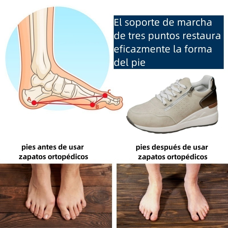 Riccicall® – Calzado ortopédico médico de diseño ergonómico que alivia el dolor de espalda, articulaciones y piernas.
