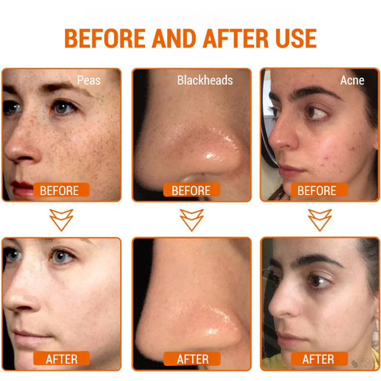 Whitening peel-off mask for sensitive skin