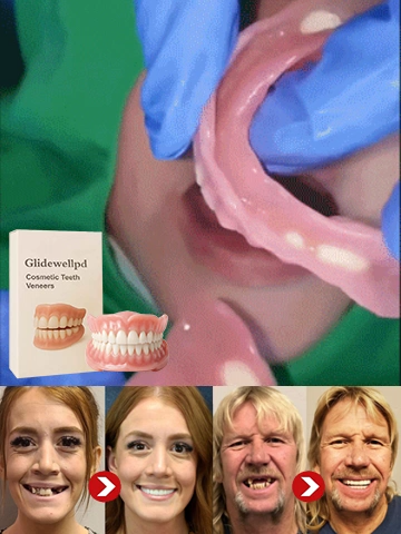 [Episches Upgrade] Premium-Vollprothese (Alles inklusive)