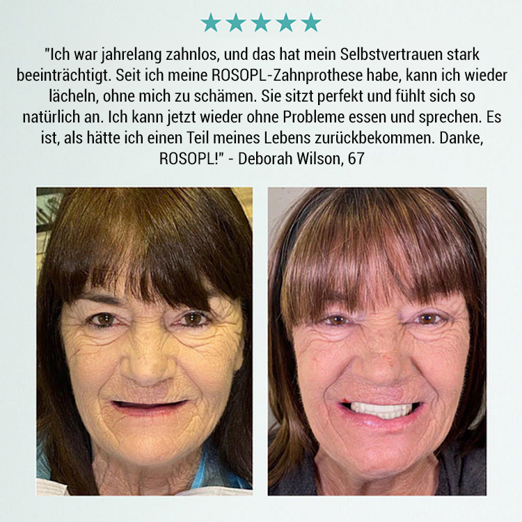 【All-Inclusive Custom】Zahnersatz Pflege- und Verschönerungsset