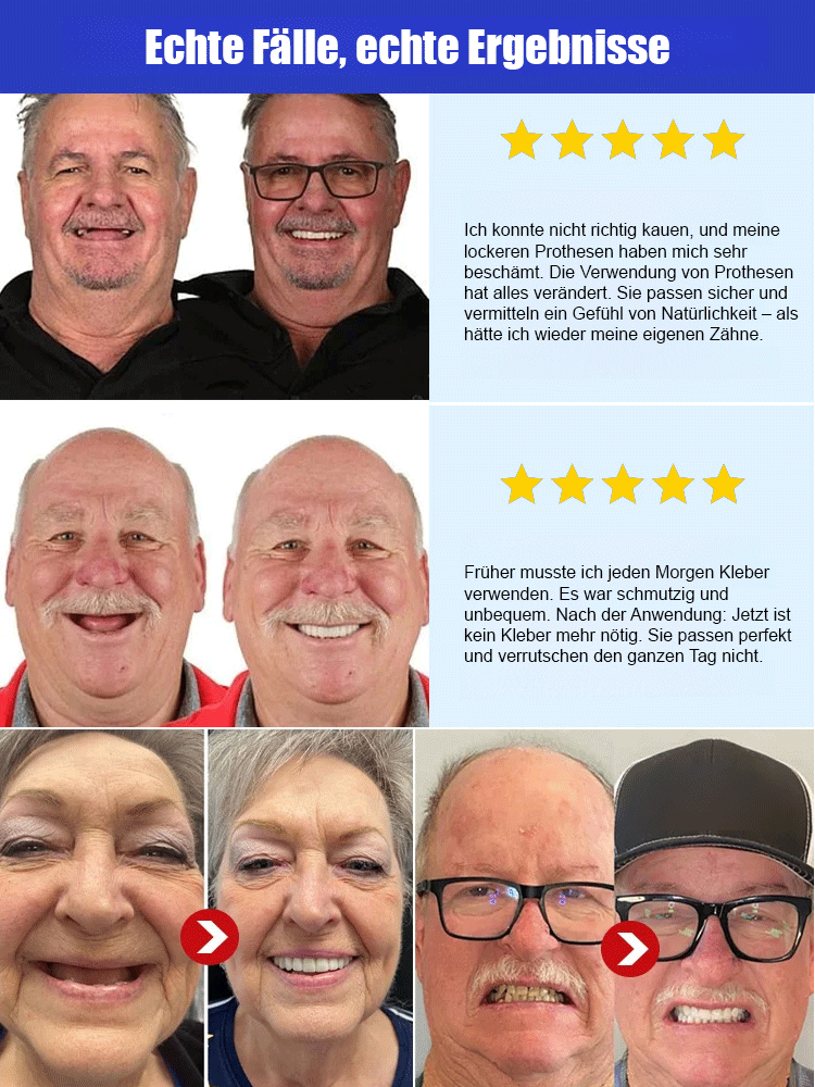 Tragbares Zahnprothesen-Etui Set – Lächeln Sie wieder selbstbewusst