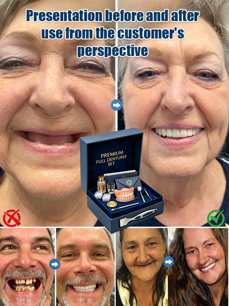 Strong Suction Full Denture for Confident Smile