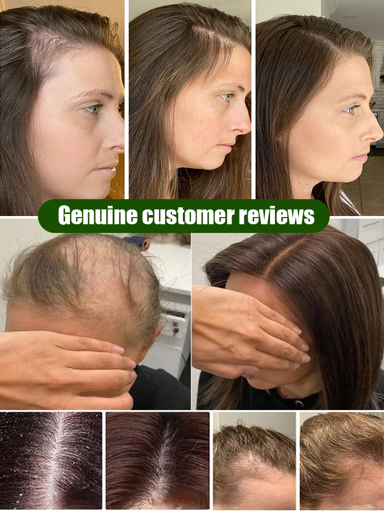 [3-Day Hair Growth] Organic Rosemary Anti-Hair Loss Shampoo
