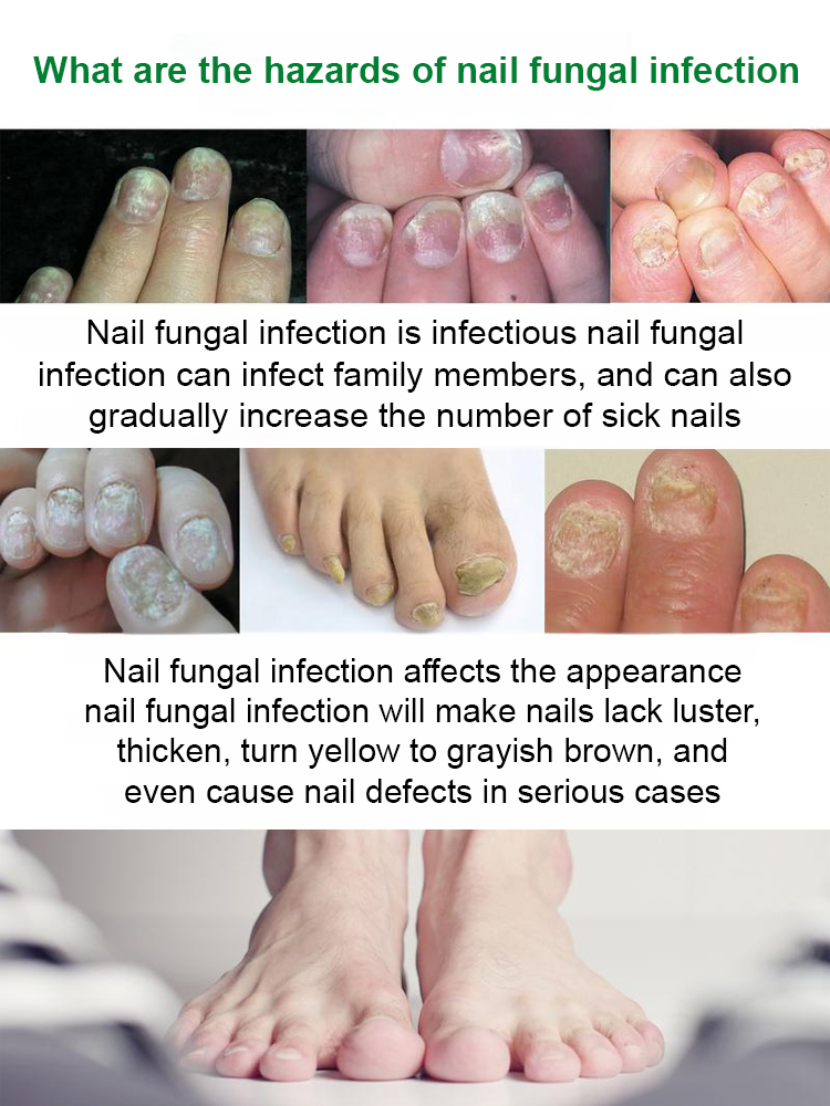 SOUTH MOON Nail Care Solution