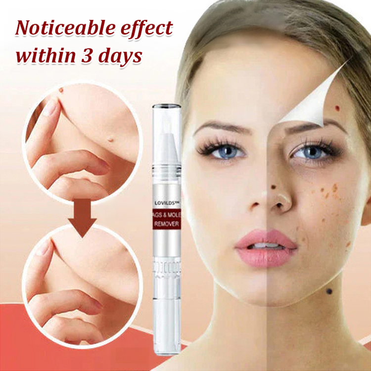 Herbal Powerful Wart Repair Pen