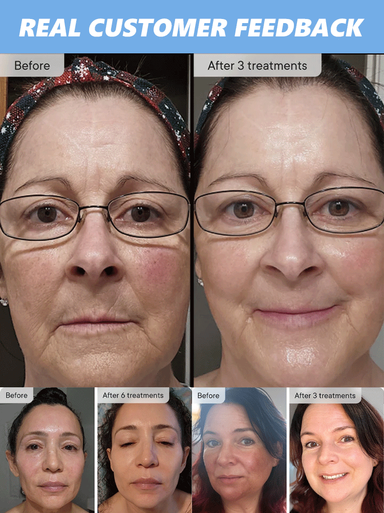 GHK-Cu Microneedling Serum Set