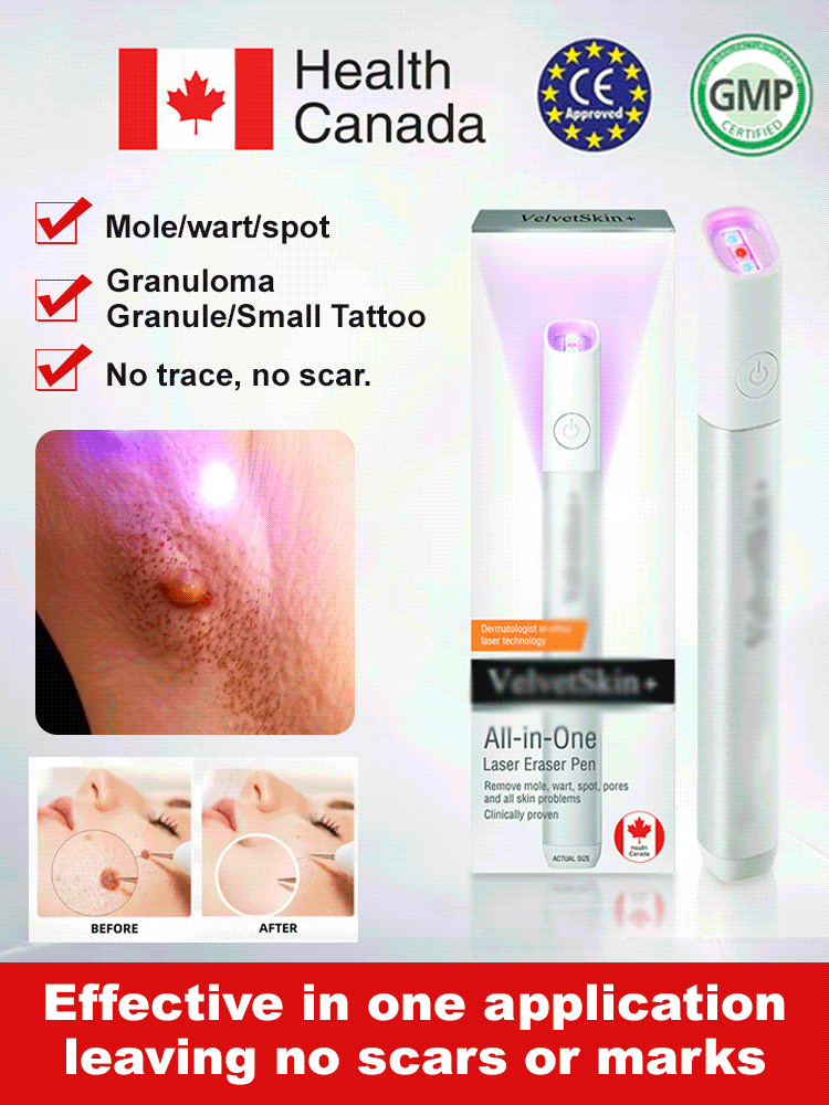 Laser mole removal pen