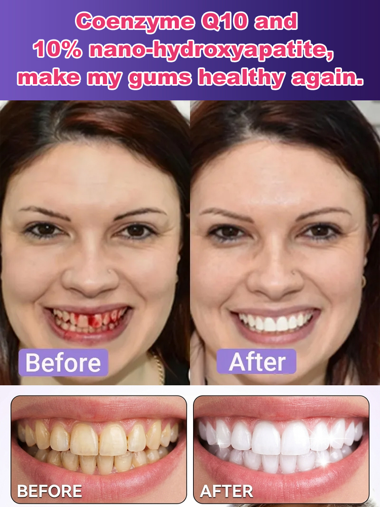🦷 Regrow Your Enamel with 10% Nano-Hydroxyapatite! ✨ The Revolutionary Tooth Powder: Repair Cavities & Whiten Teeth Naturally! 💎 Say Goodbye to Sensitivity Forever – Professional Dental Care at Home! 🛡️✅
