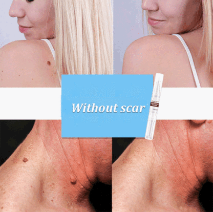 Herbal Powerful Wart Repair Pen