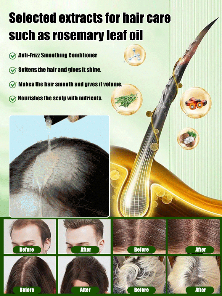 [3-Day Hair Growth] Organic Rosemary Anti-Hair Loss Shampoo