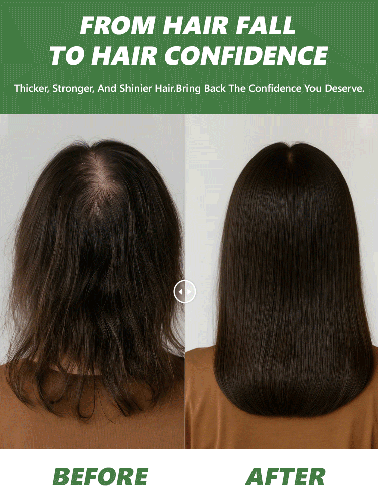 【Hair Growth + Hair Care】Natural Regeneration Dense Rosemary Shampoo