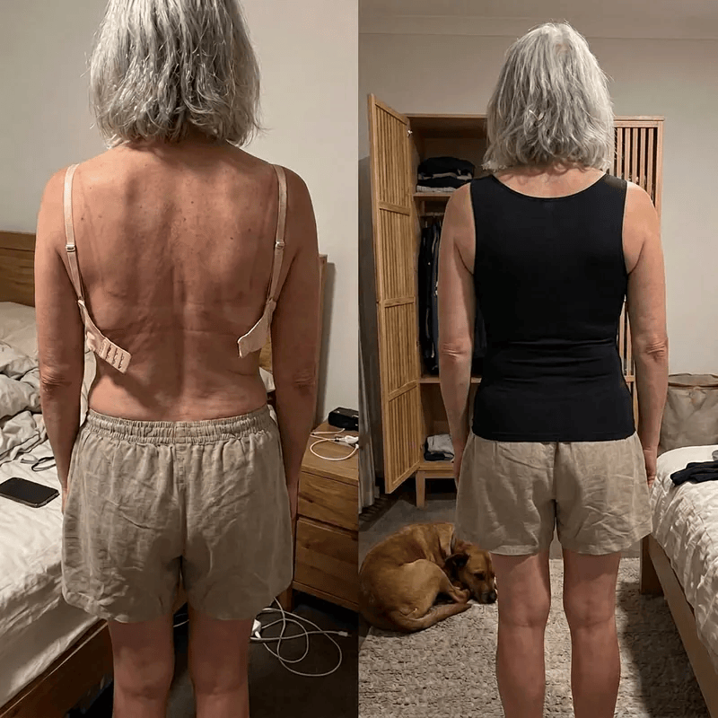⏰Promotion 65% OFF Say Goodbye To Bras For Good – Without Giving Up Support