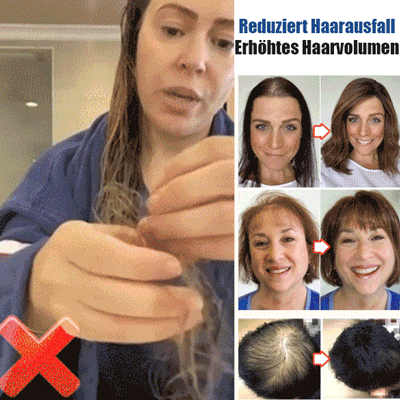  Roll-on-Serum zur Vorbeugung von Haarausfall, Stärkung der Haarwurzeln und Förderung des Haarwachstums