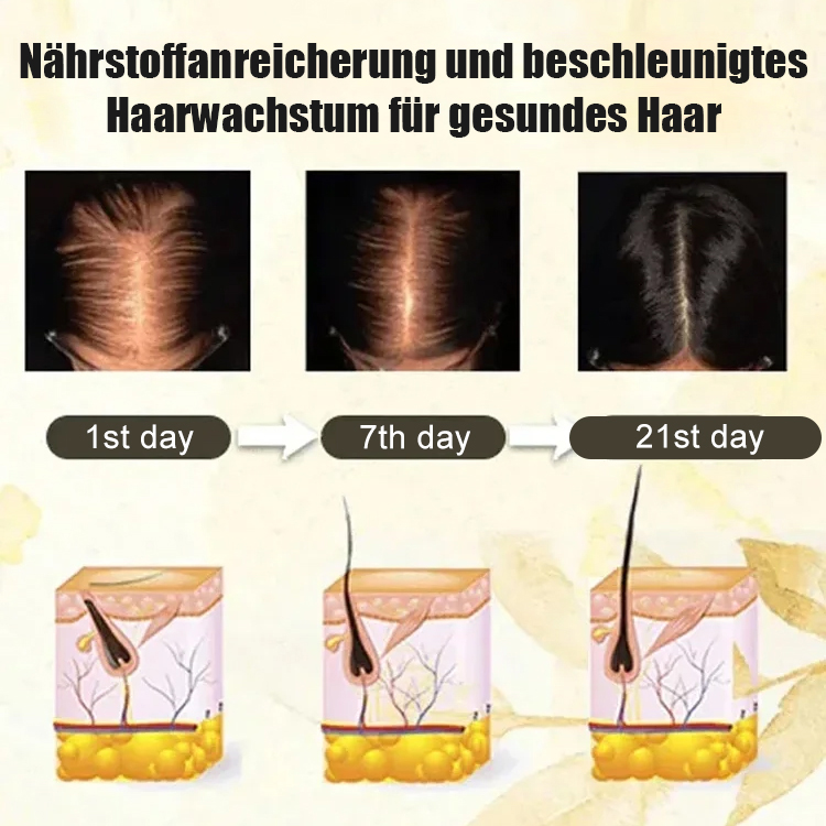  Roll-on-Serum zur Vorbeugung von Haarausfall, Stärkung der Haarwurzeln und Förderung des Haarwachstums