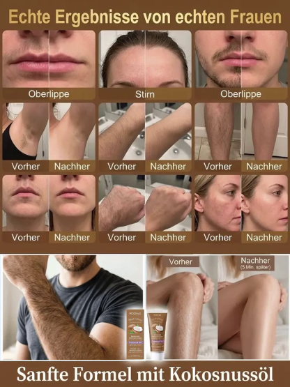100% natürliche Enthaarungscreme mit Kokosöl 🥥 Sanft, schnell, langanhaltend – Nie wieder Schmerzen beim Rasieren oder Waxing✨