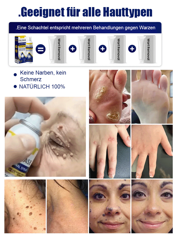 Kühlspray für angenehme Frische ✨️Reine und weiche Haut in 1 Woche (100% natürlich)👍️